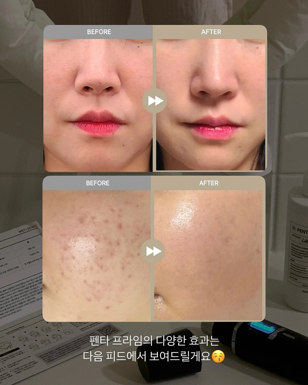 개미 생태 관찰 키트 17