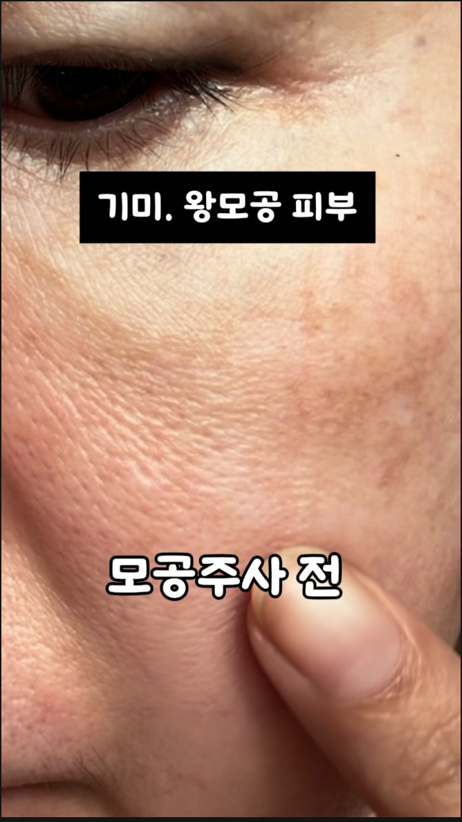 성시경 레시피 양배추 요리