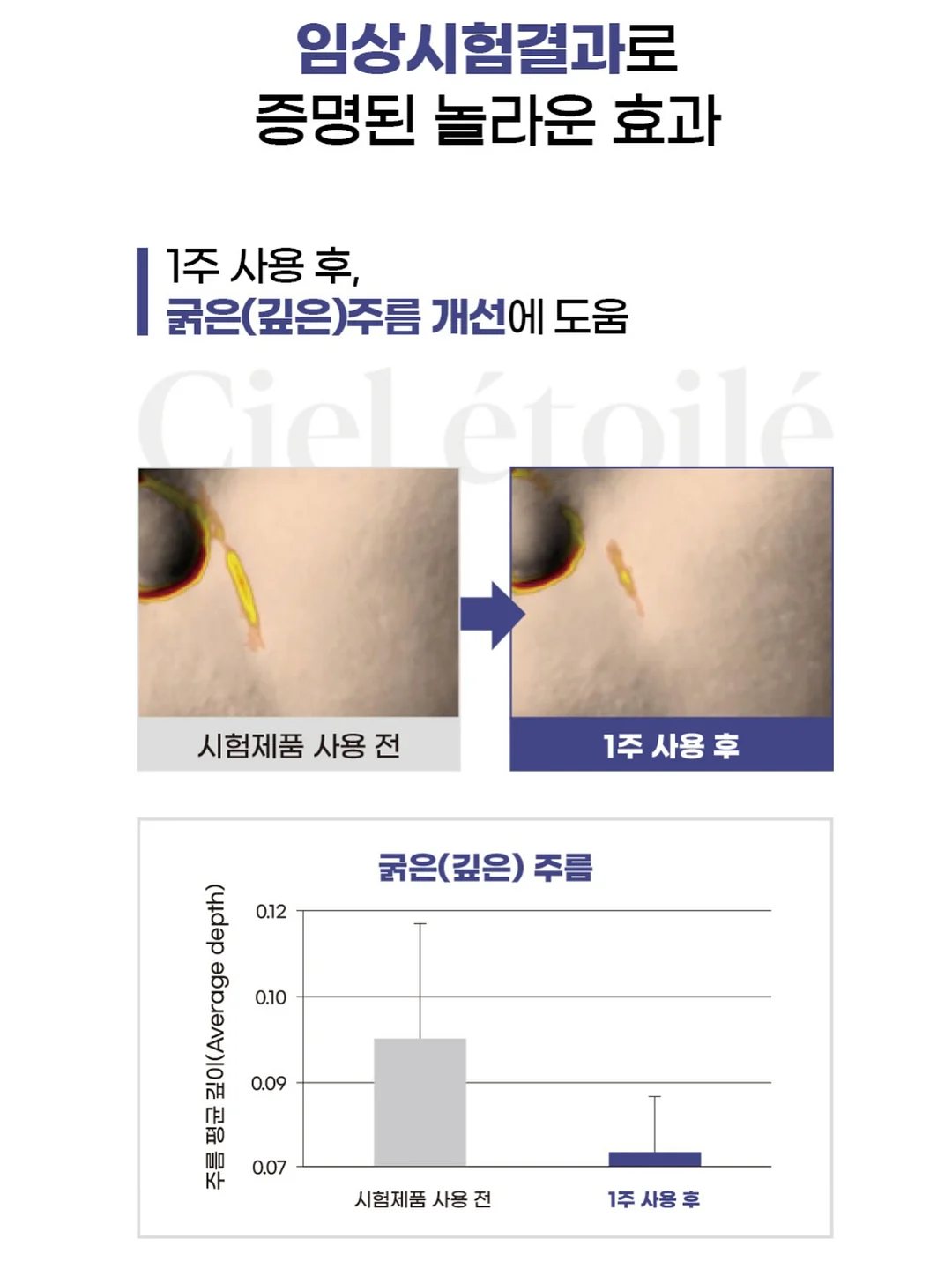조합 코디 12