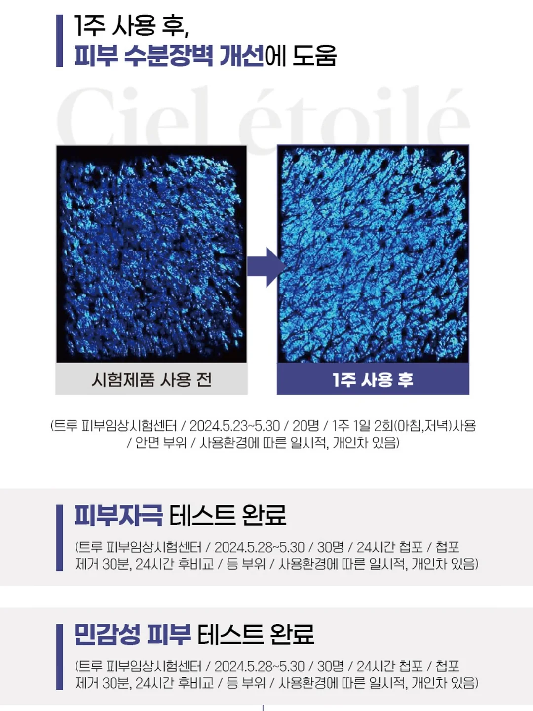 조합 코디 13