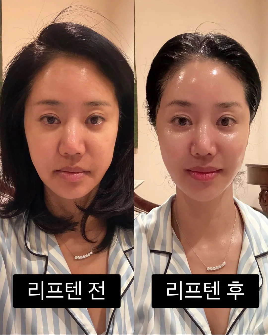 구단/선수 이름표 추가 옵션 11