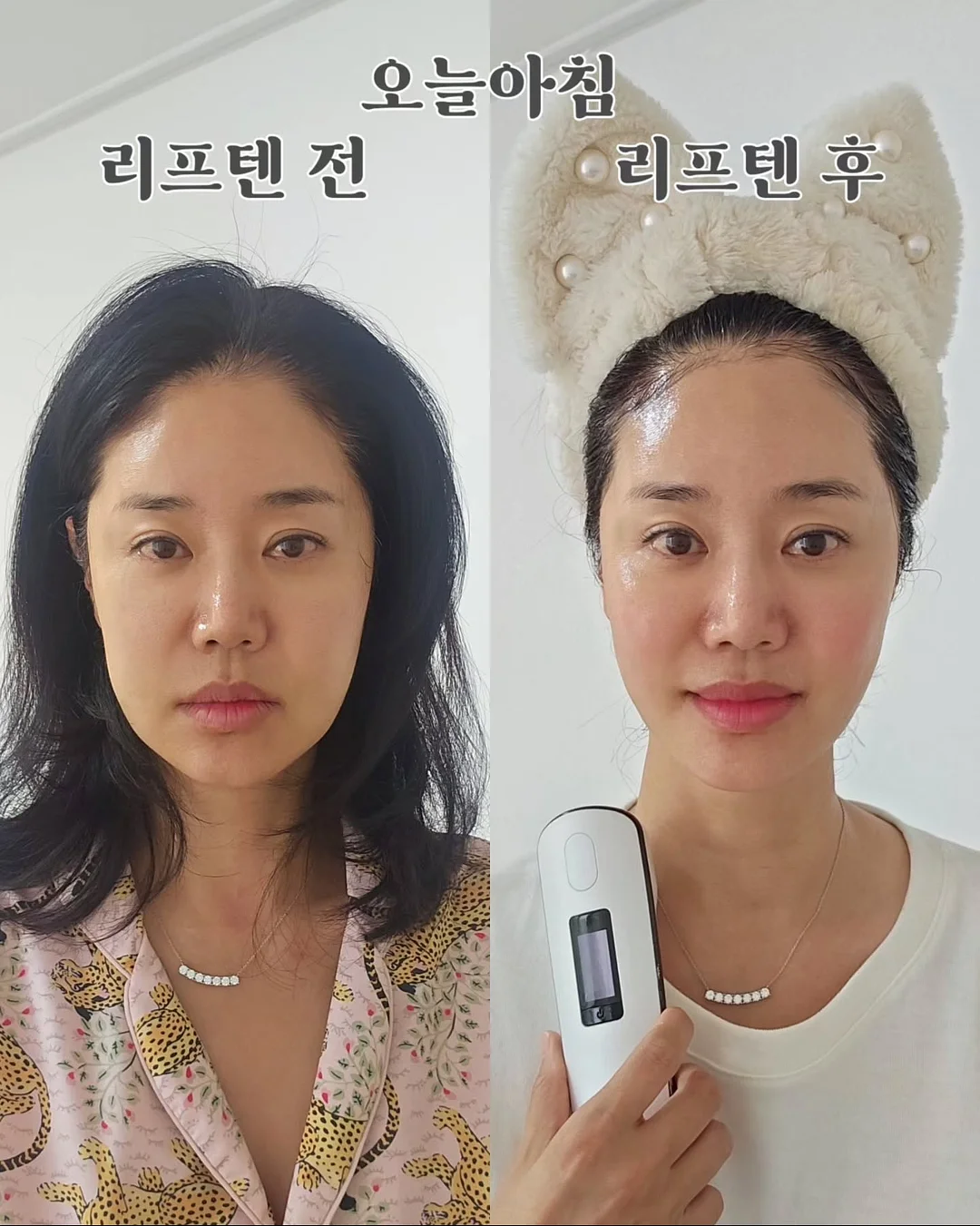 구단/선수 이름표 추가 옵션 15