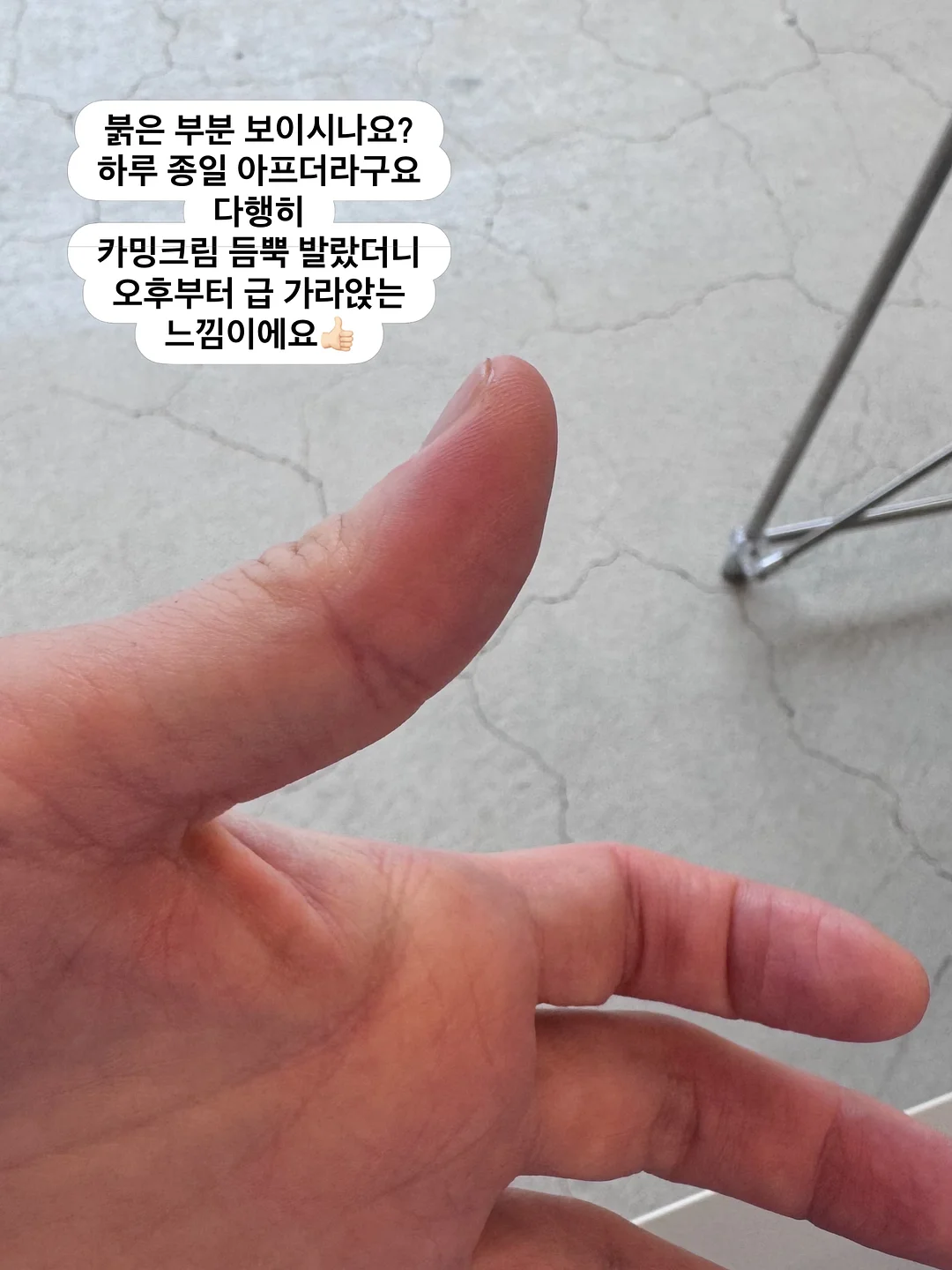 팔 당기는 치킨윙 교정 연습방법 12