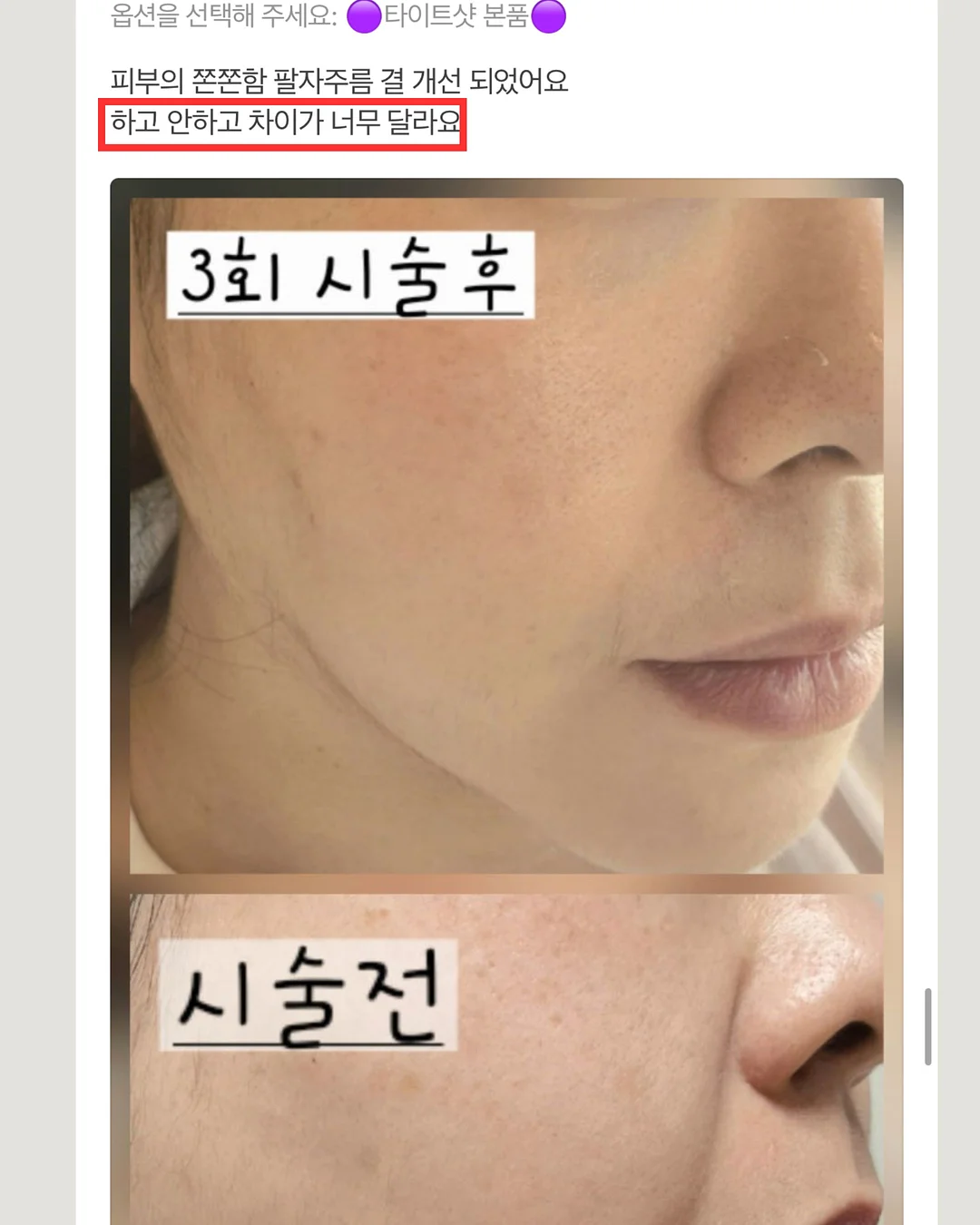 여름휴가룩 투피스 세트 4