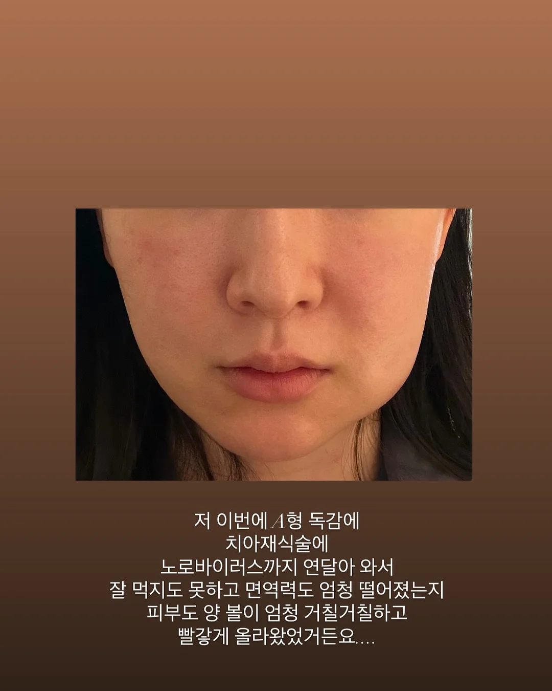 베이프 사루 반팔티 3