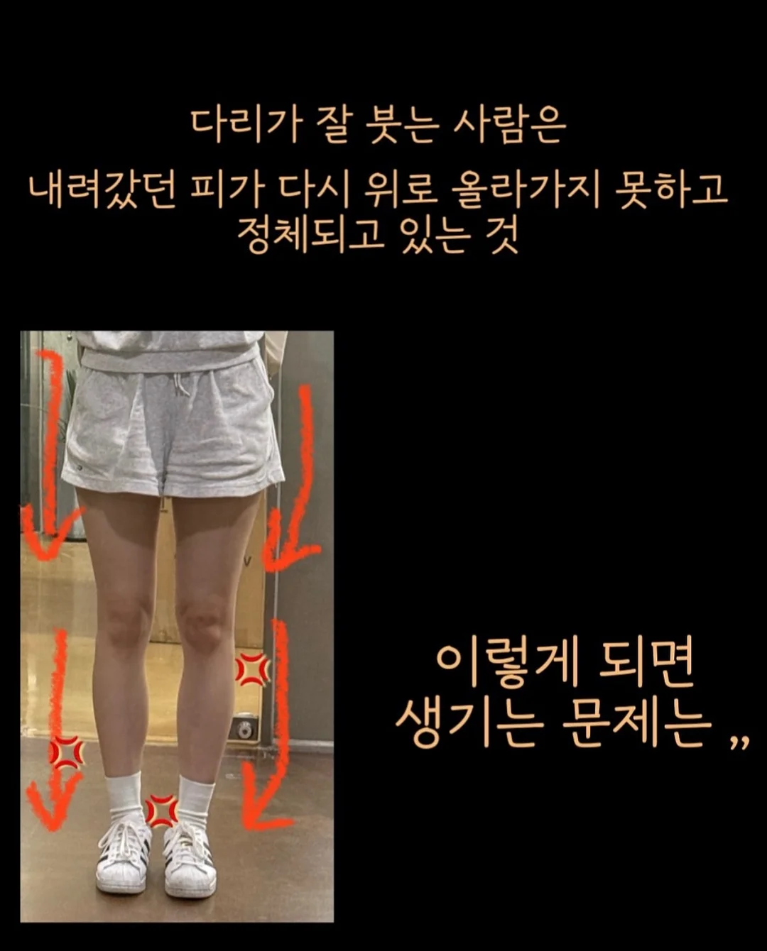 아식스 슈퍼블라스트 3 7