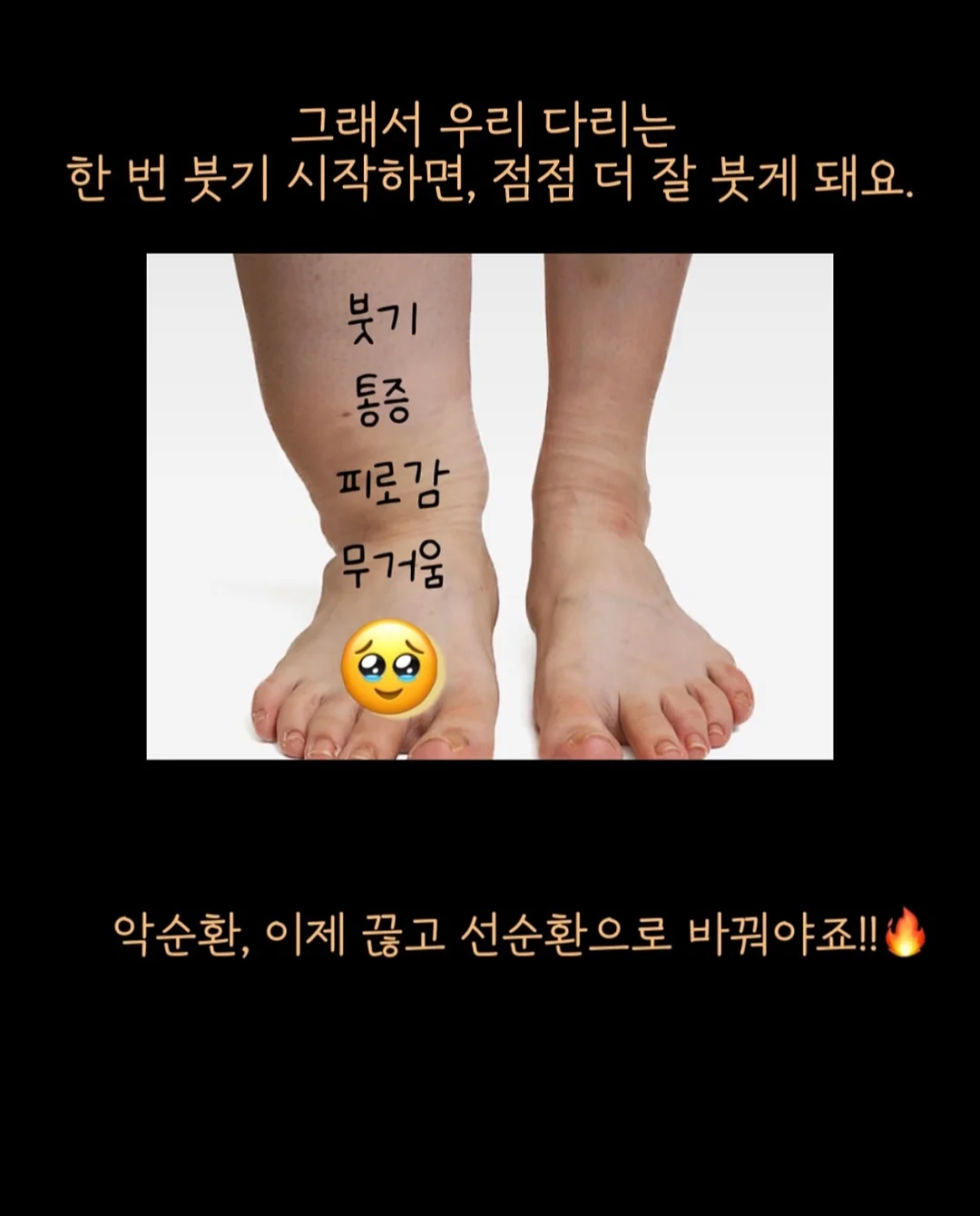 아식스 슈퍼블라스트 3 9