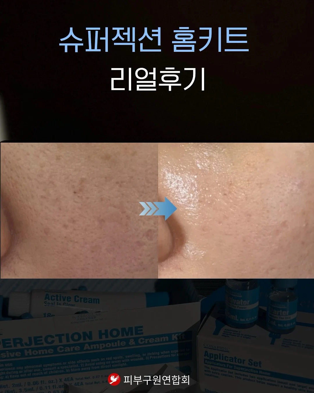 독서템 8