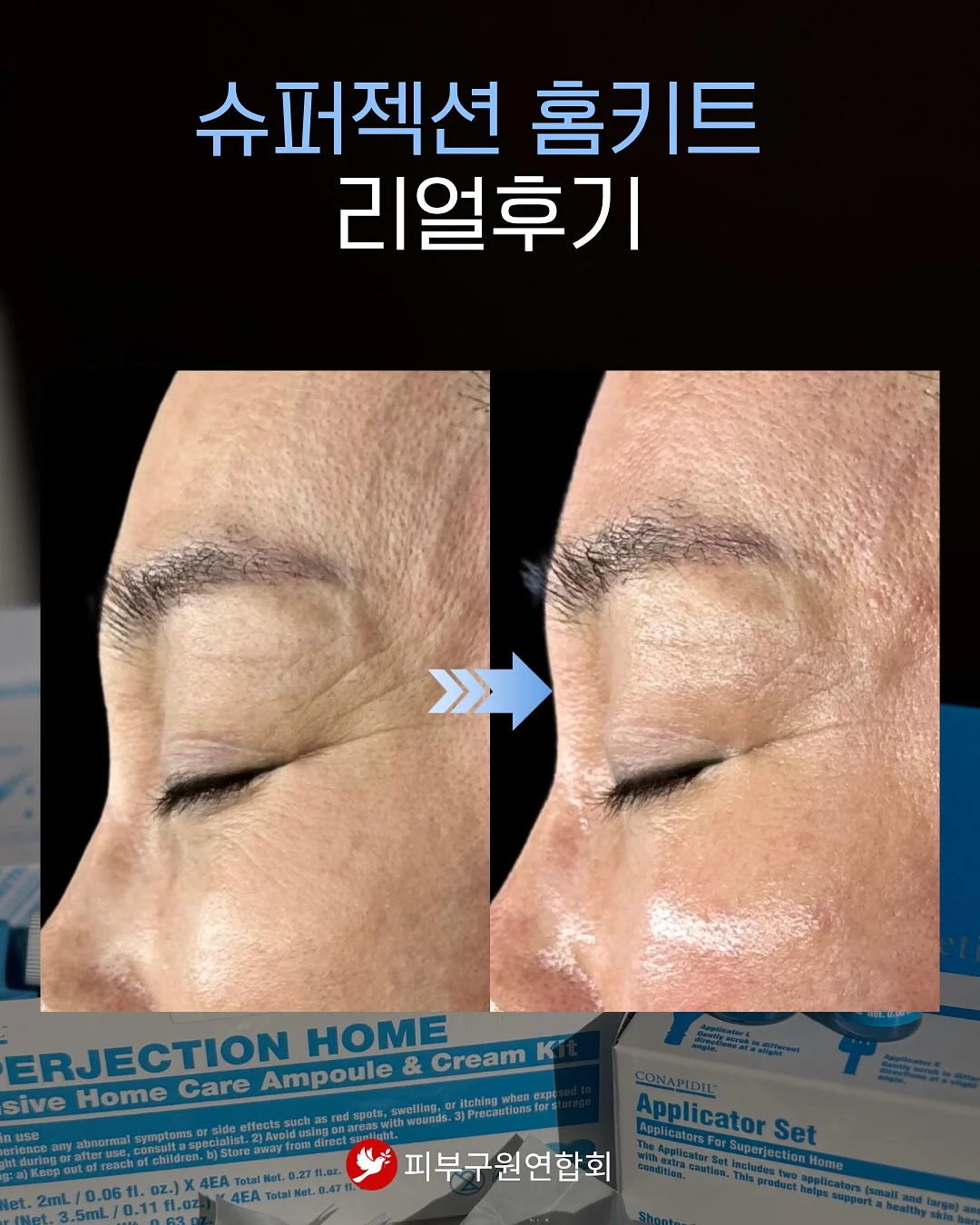 독서템 9