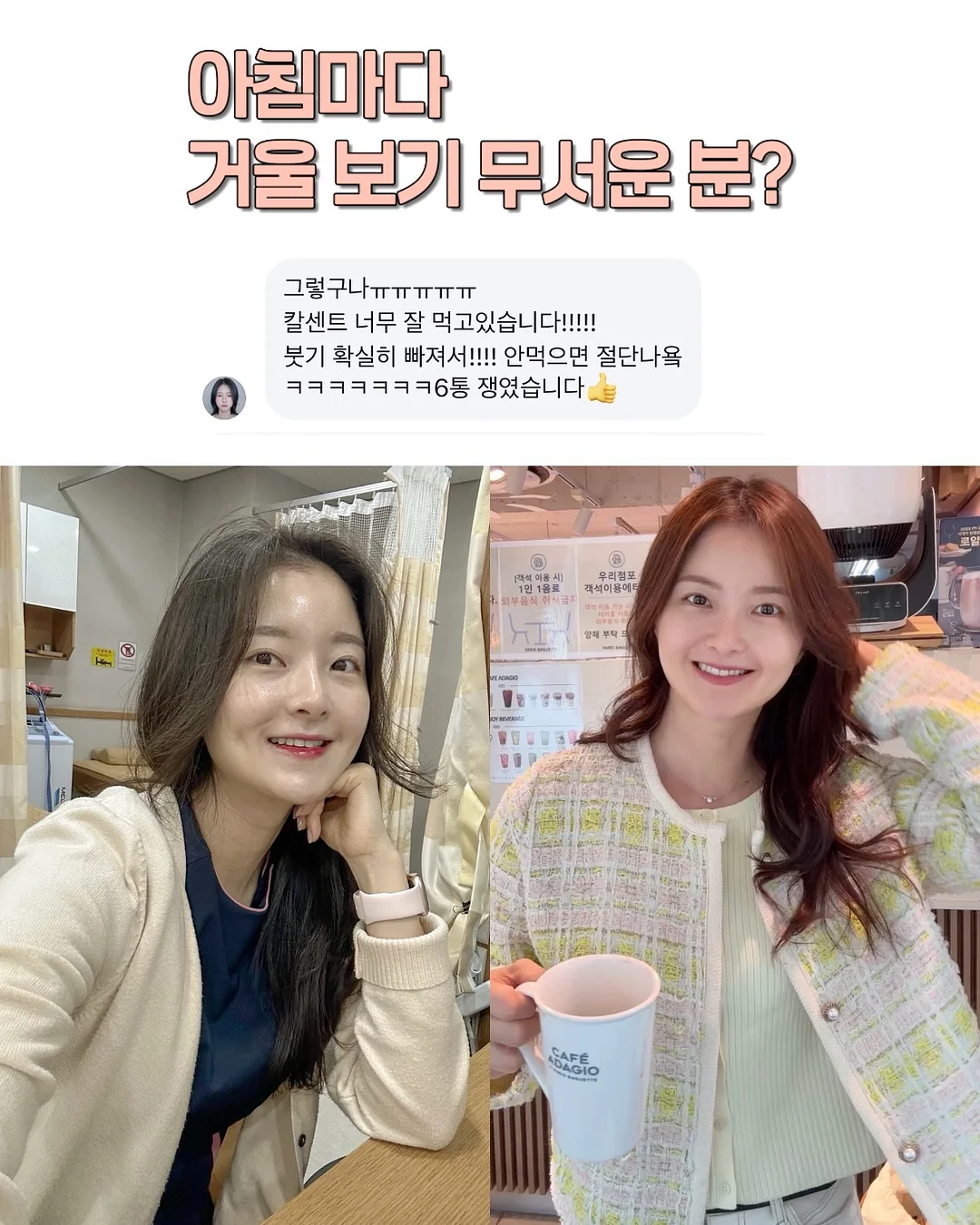 엘레나 여성 질유산균 12