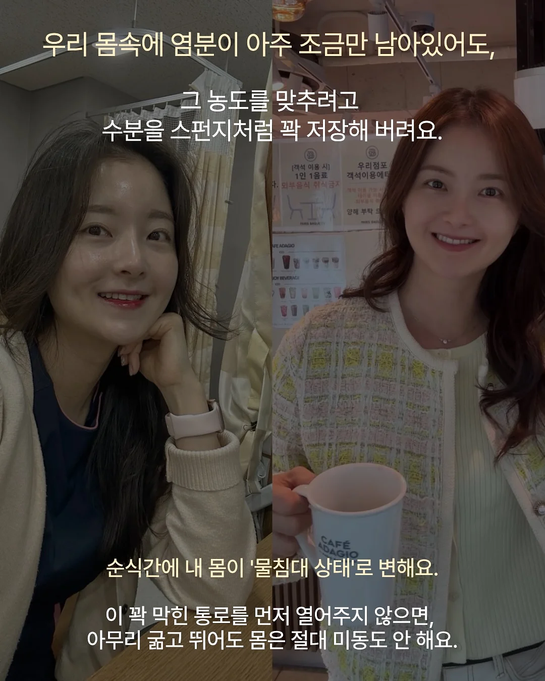 엘레나 여성 질유산균 7