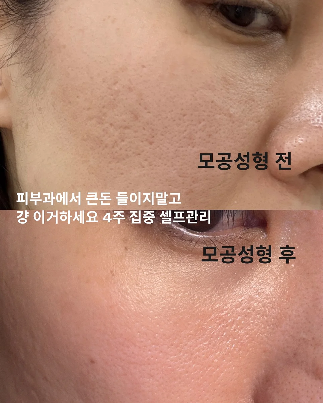 닥터리코스 PDRN 부스터 앰플 8