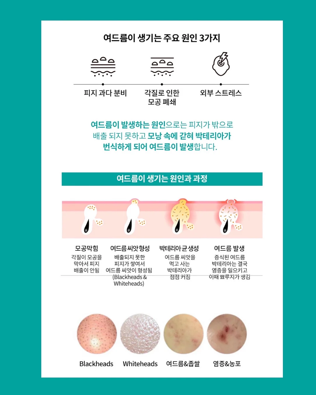 헤드스파 체험 13