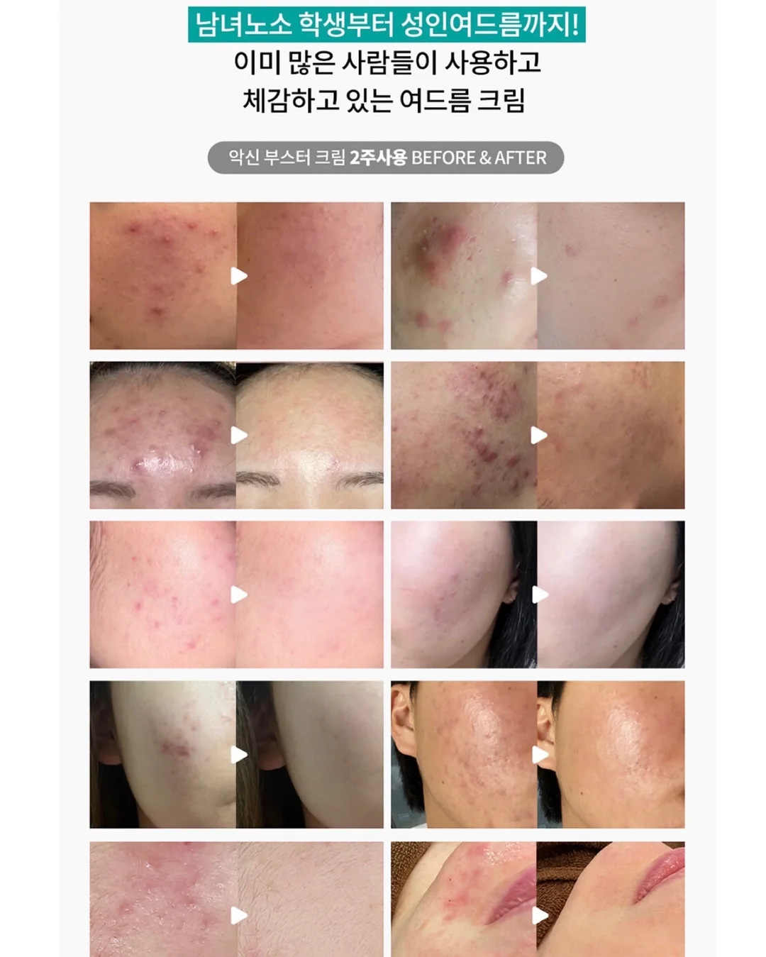 헤드스파 체험 15