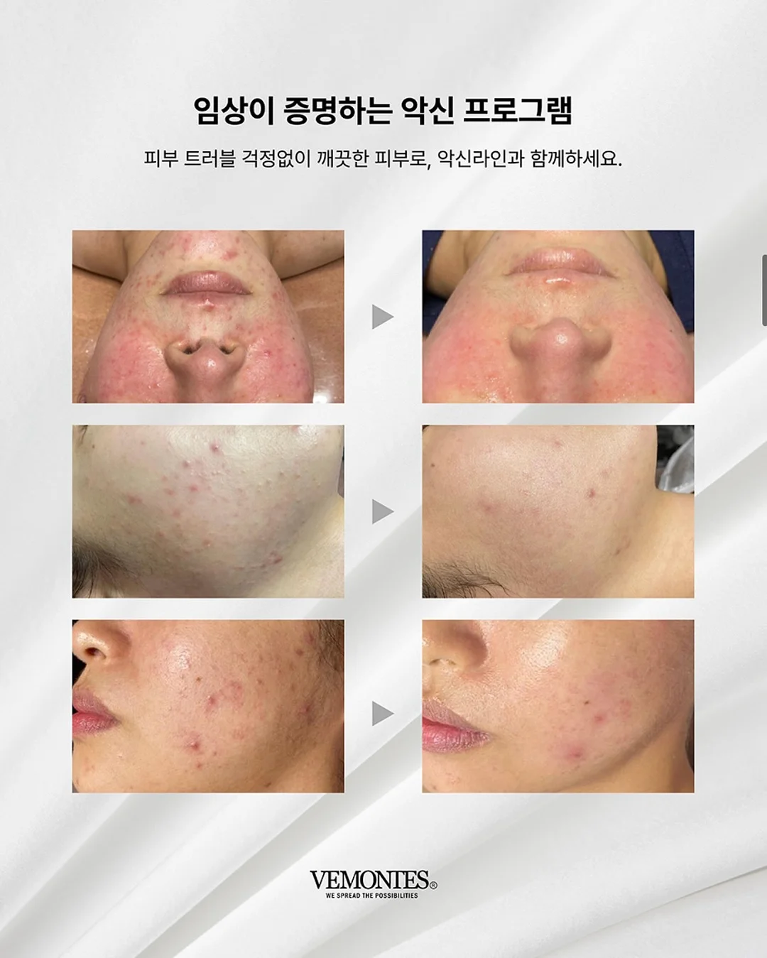 헤드스파 체험 7