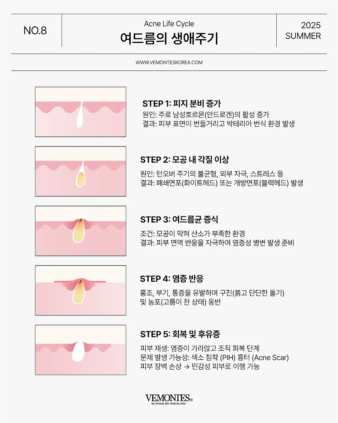 헤드스파 체험 10