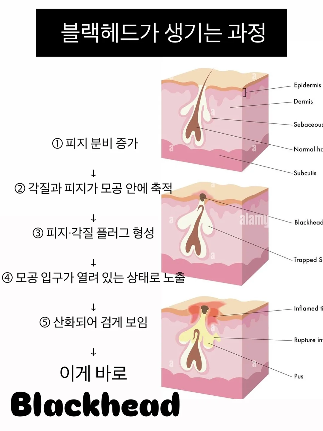 무항생제 햄 6