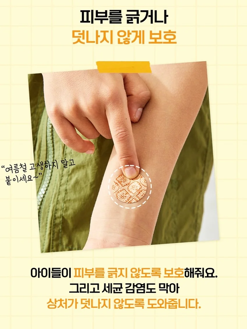 프로그 니트릴 장갑 10