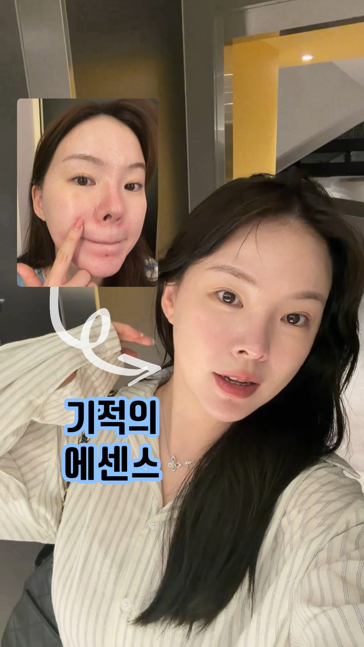 남성 근육 필러
