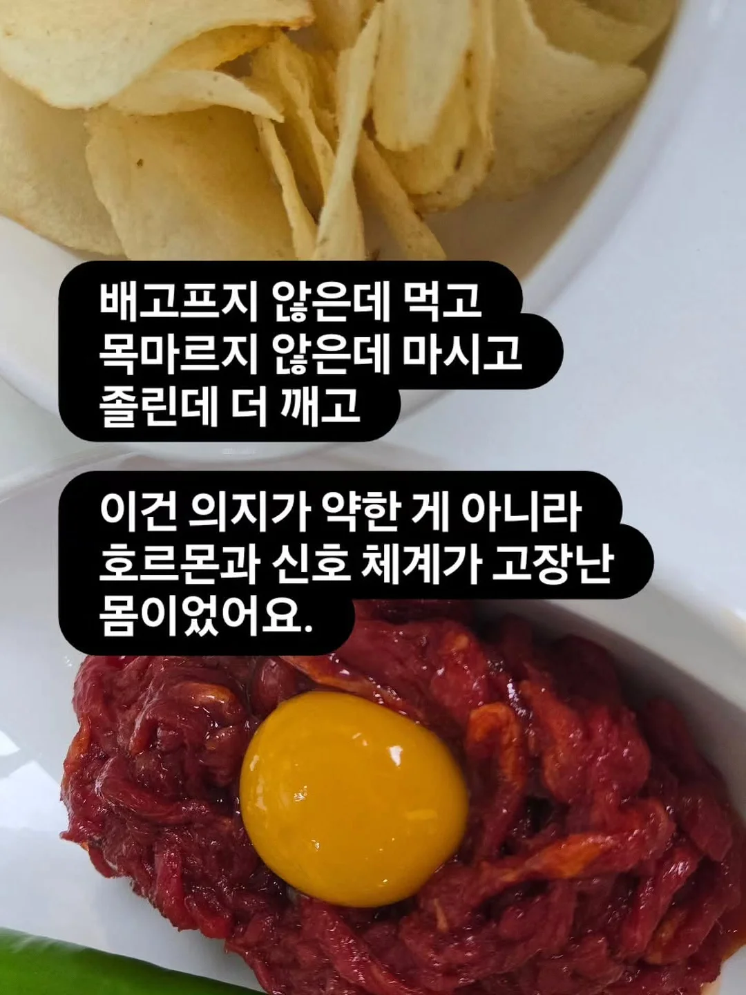 네일아트 시술 6