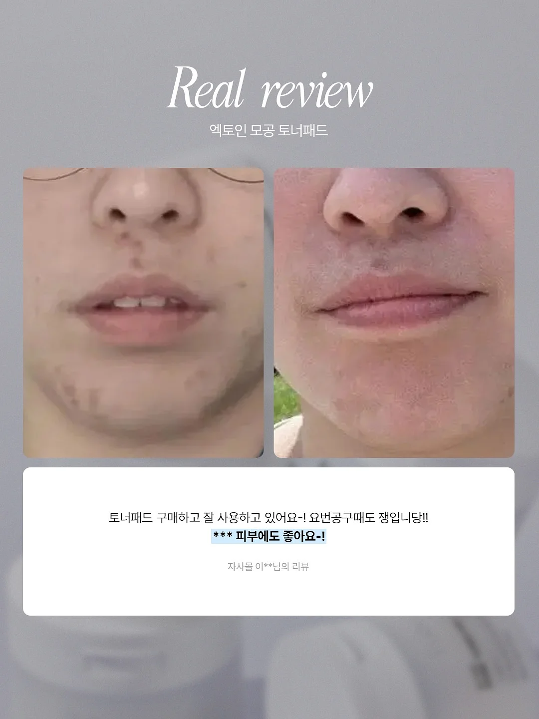 멜로우 3pcs 셋업 6
