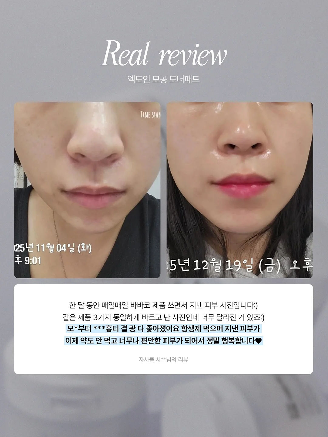 멜로우 3pcs 셋업 7