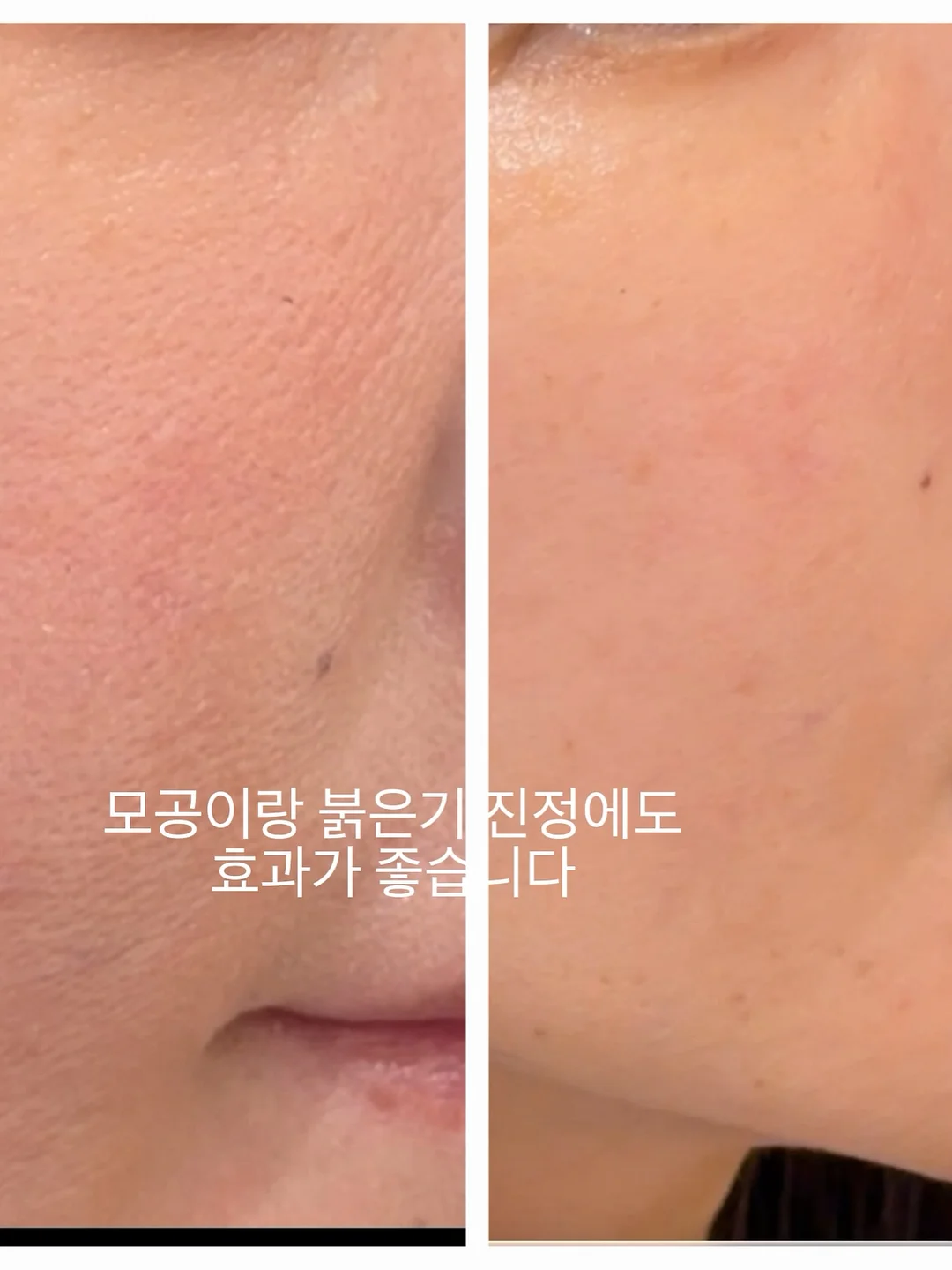 멜로우 3pcs 셋업 9