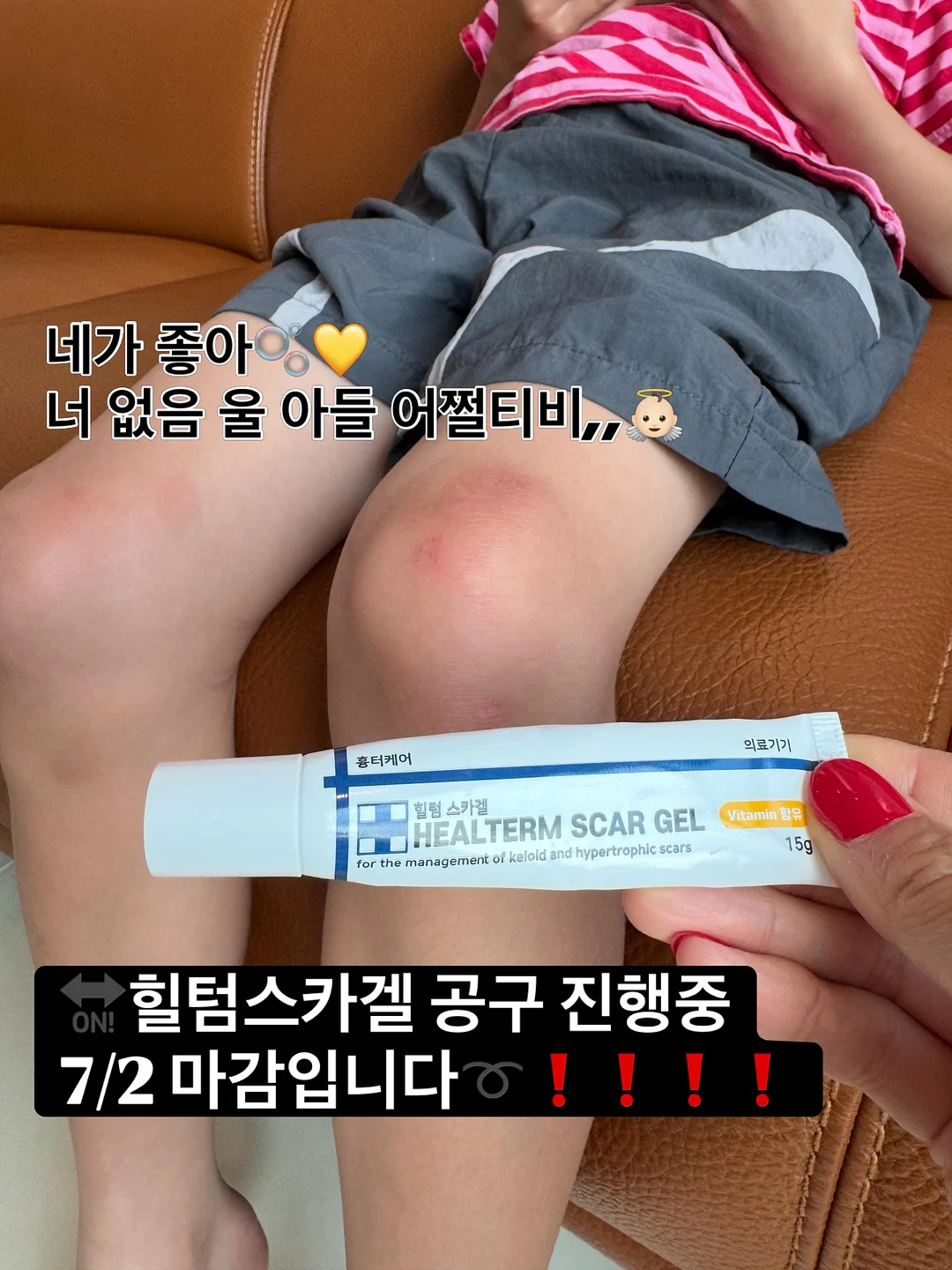 식물 1
