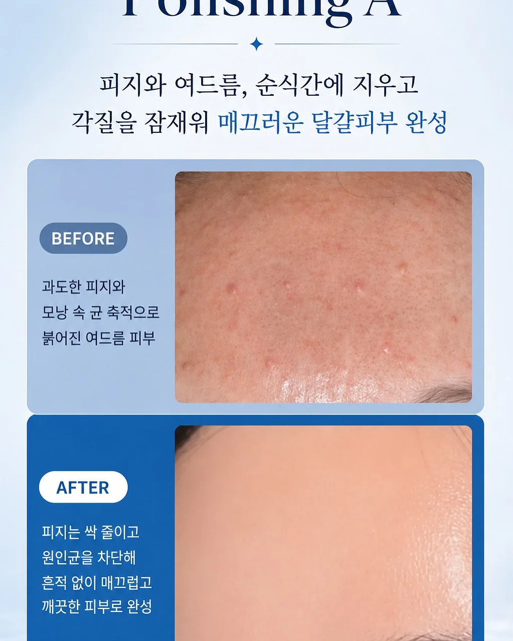 베른호이체 피아노 4