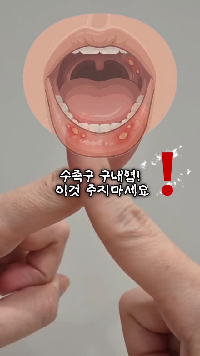 브라탑