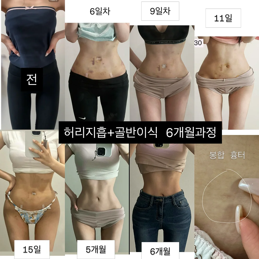 도트나시 1