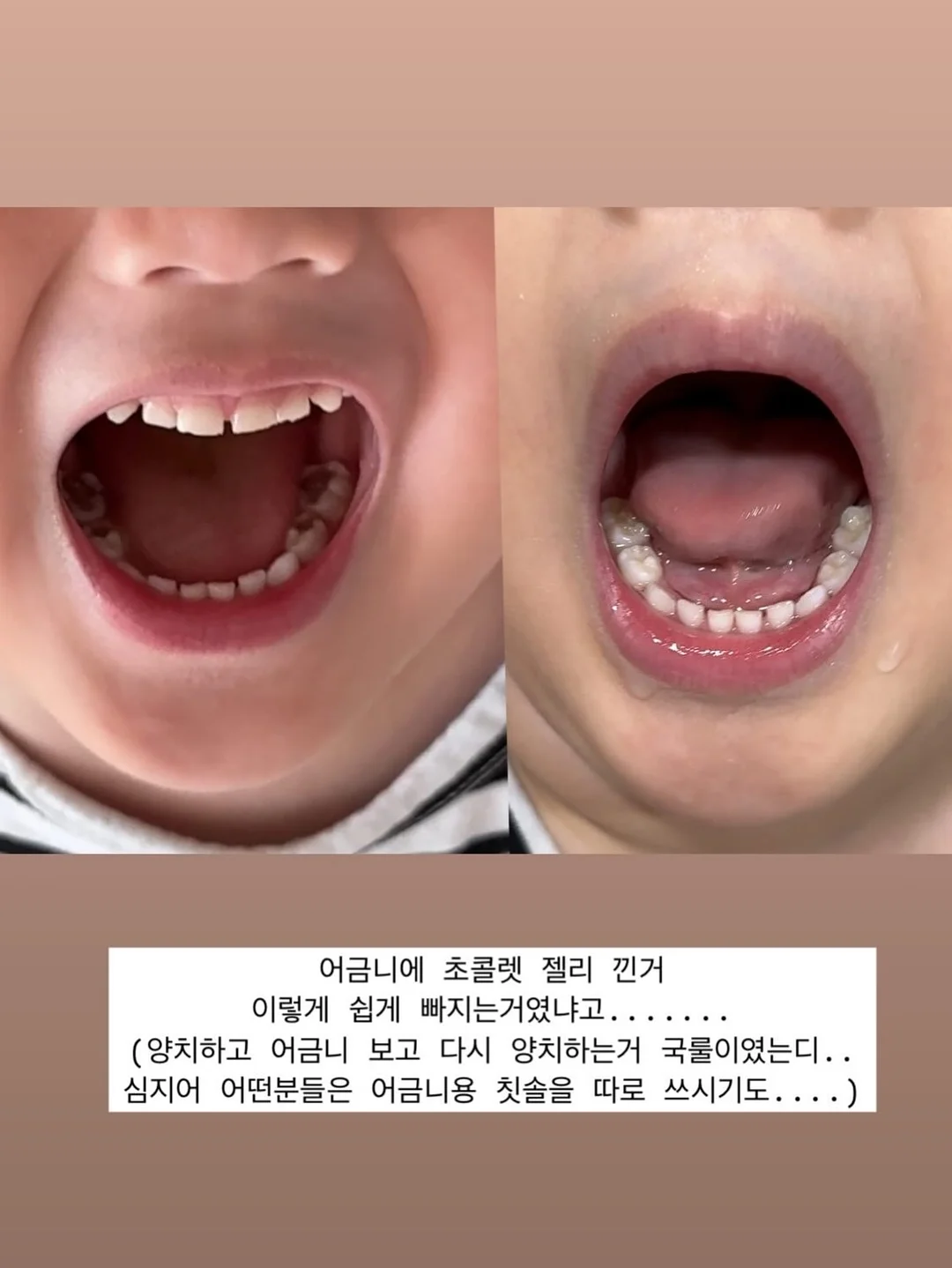 여름, 아이스크림! 10