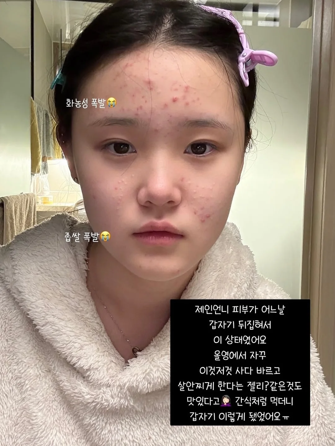 우사하나 네일 8