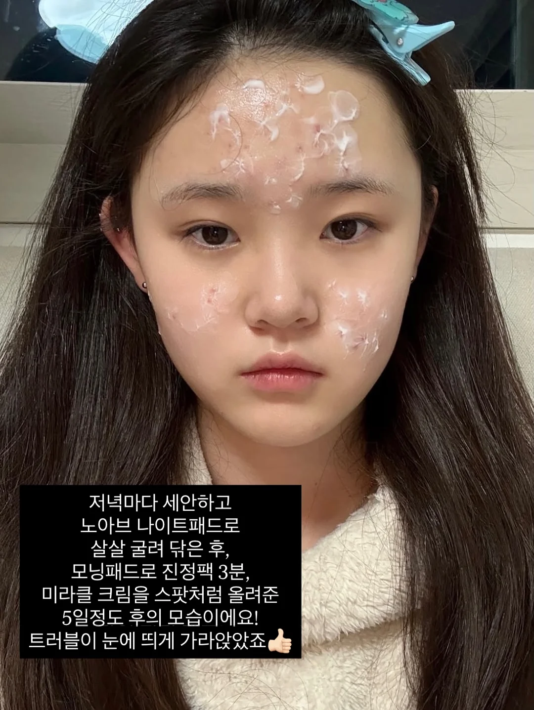 우사하나 네일 9