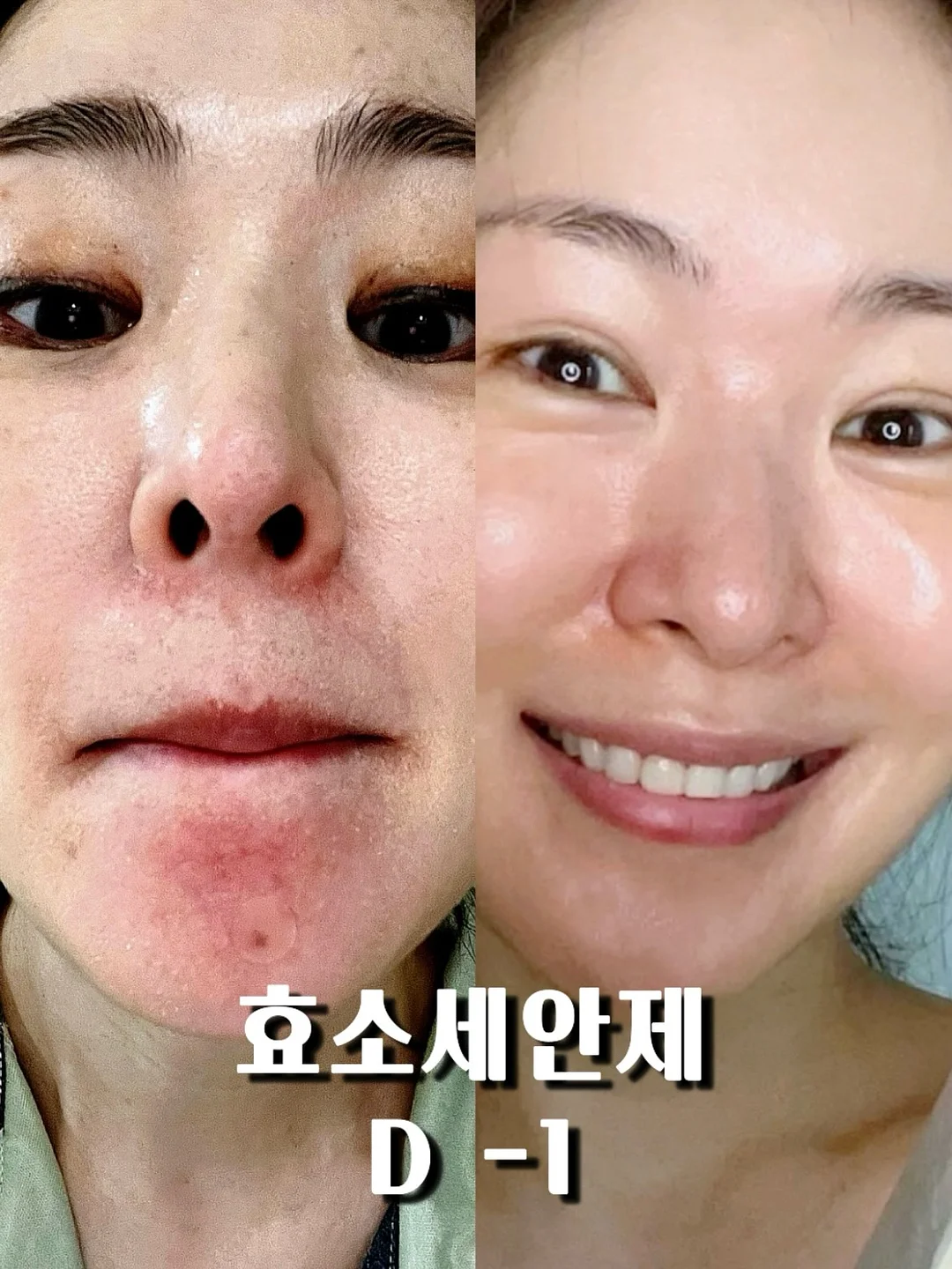 회피형과 건강하게 연애하는 방법 영상 칼럼 1