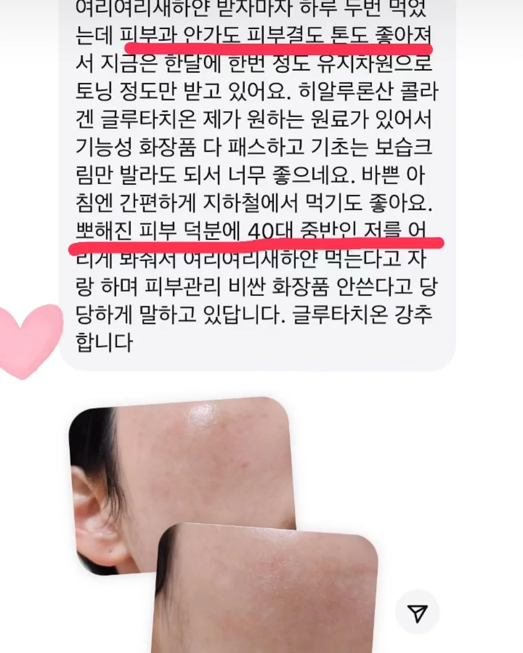 손목구명팔찌 15