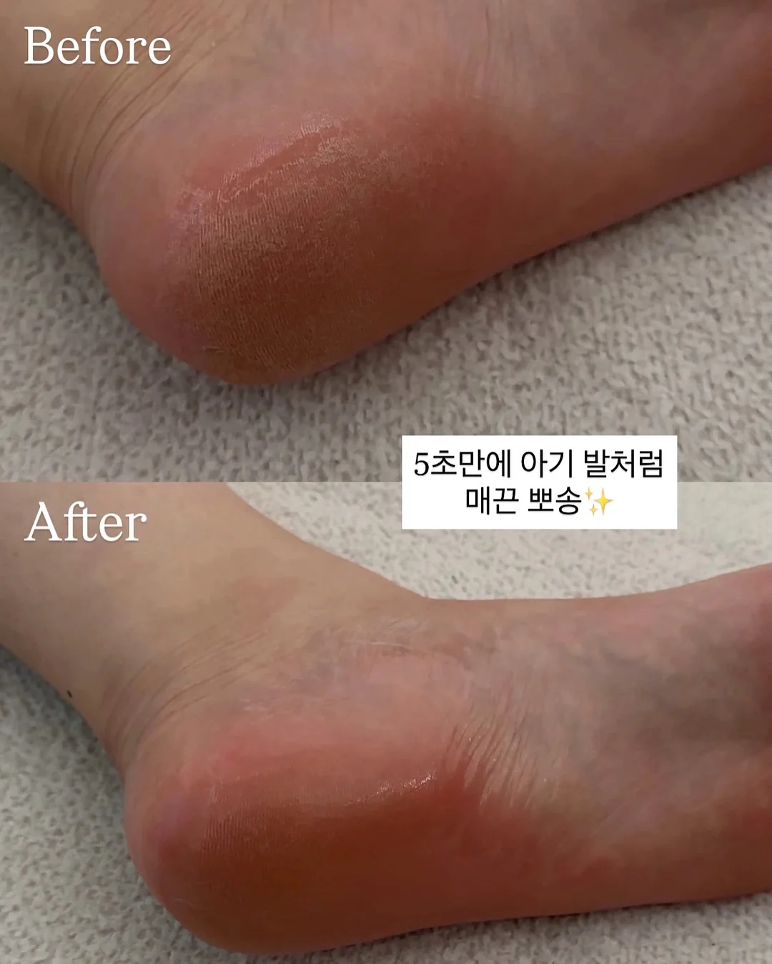 하그노스 이너웨어 2종 4