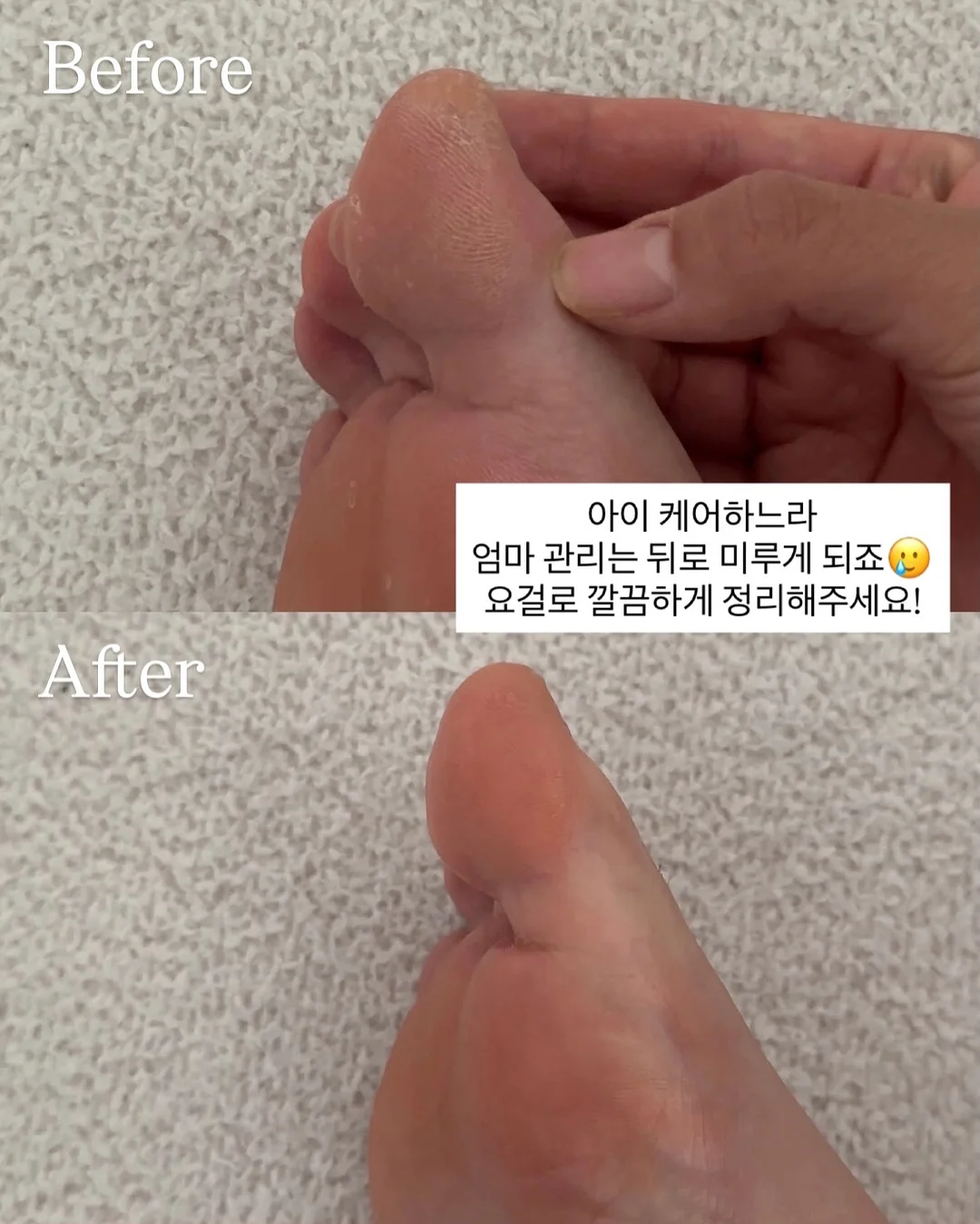 하그노스 이너웨어 2종 8