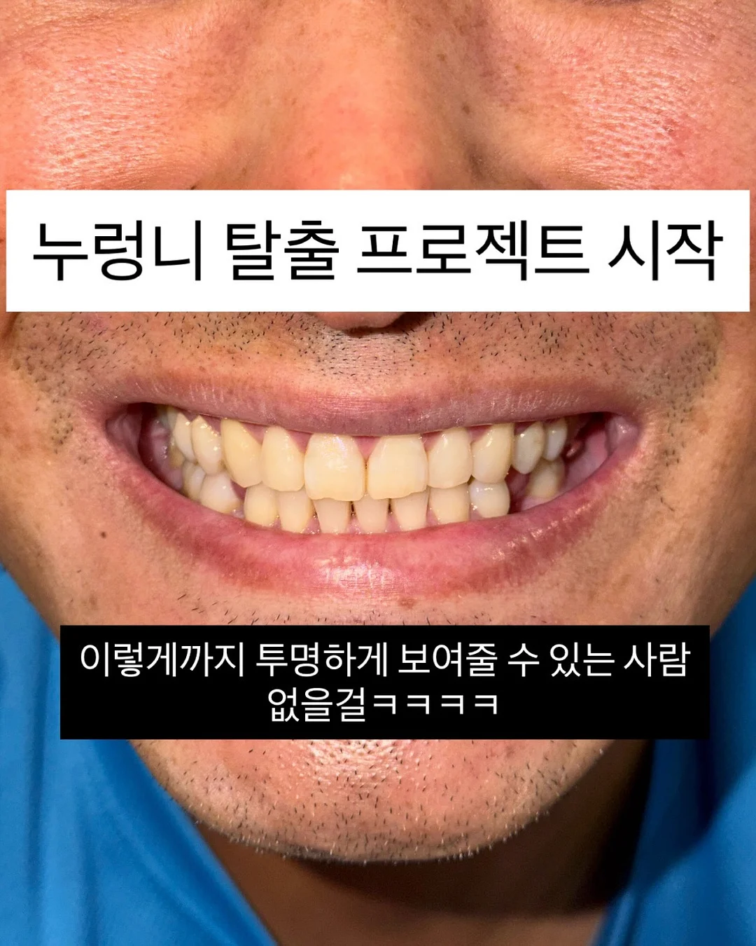 로지플로 아기 보행기 튜브 3