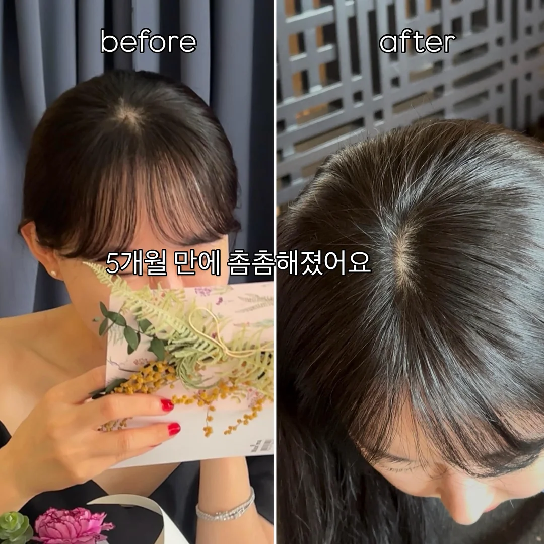 린넨 패드 미디엄 원피스 1