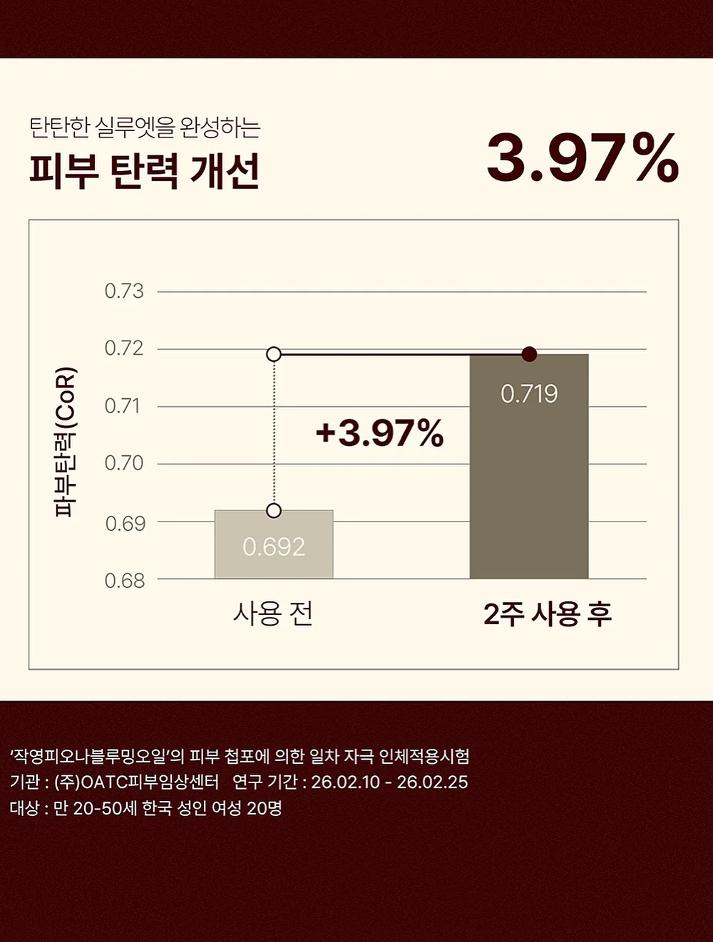 에어리돗 매쉬집업 상하세트 5