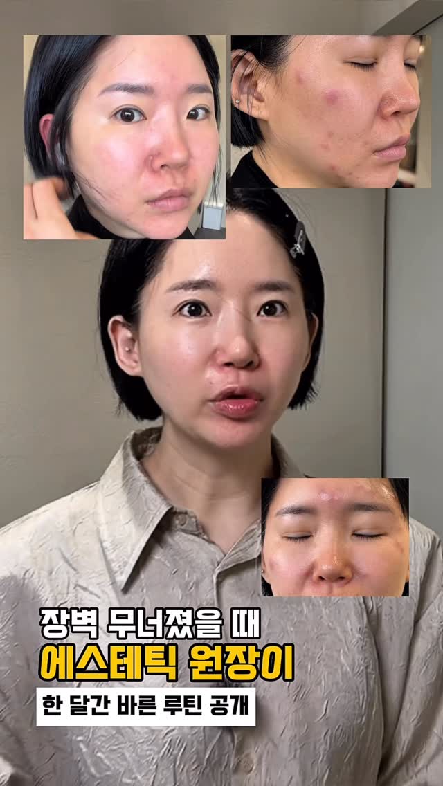 쏘이지 대사회복 루틴방