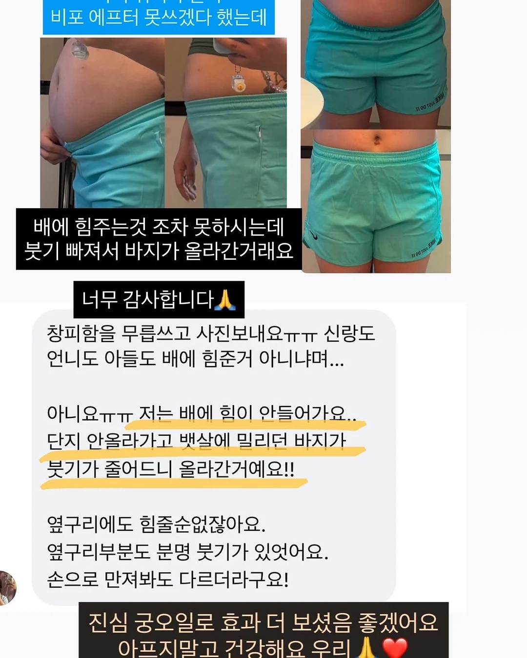 윤곽 관리 5