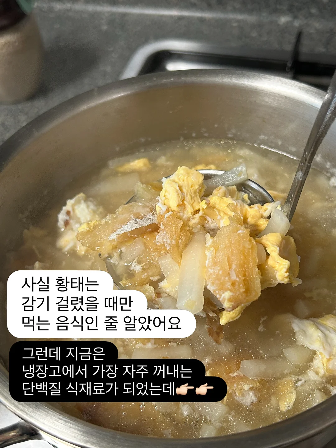 휴비딕 휴대용 콧물흡입기 2