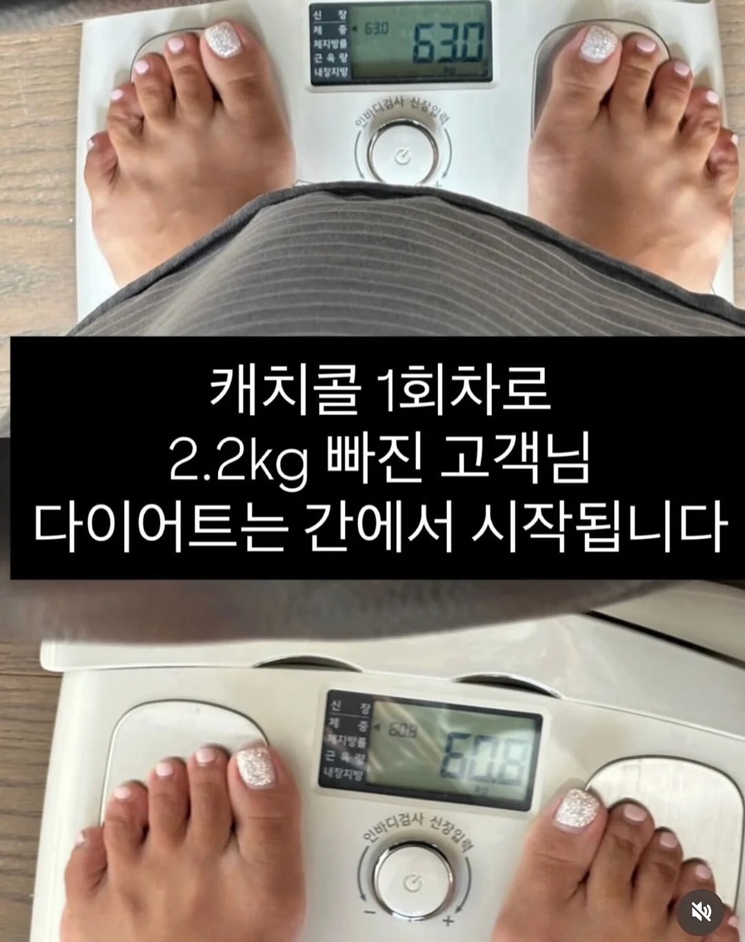 이지아이 페르띠 샌들 6