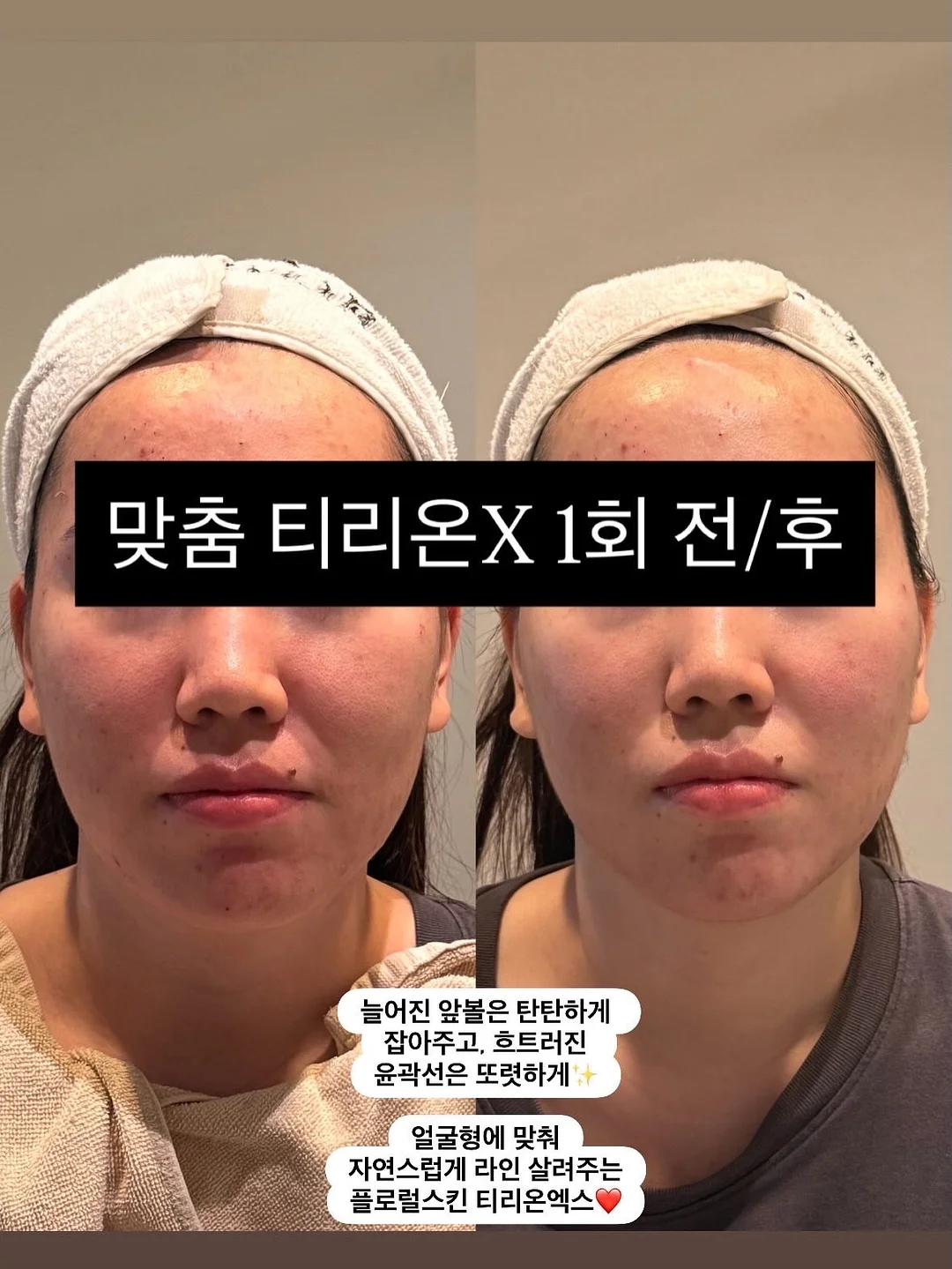 AXE 스프레이 데오드란트 1
