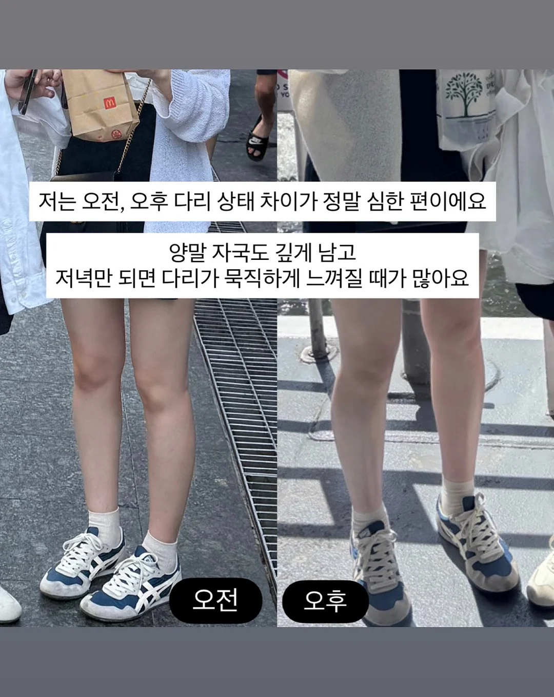 자연눈썹 시술 2