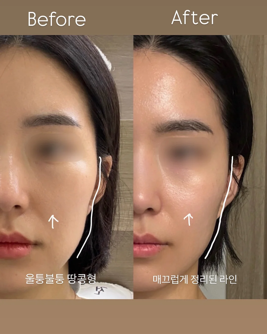 야외 텐트 14
