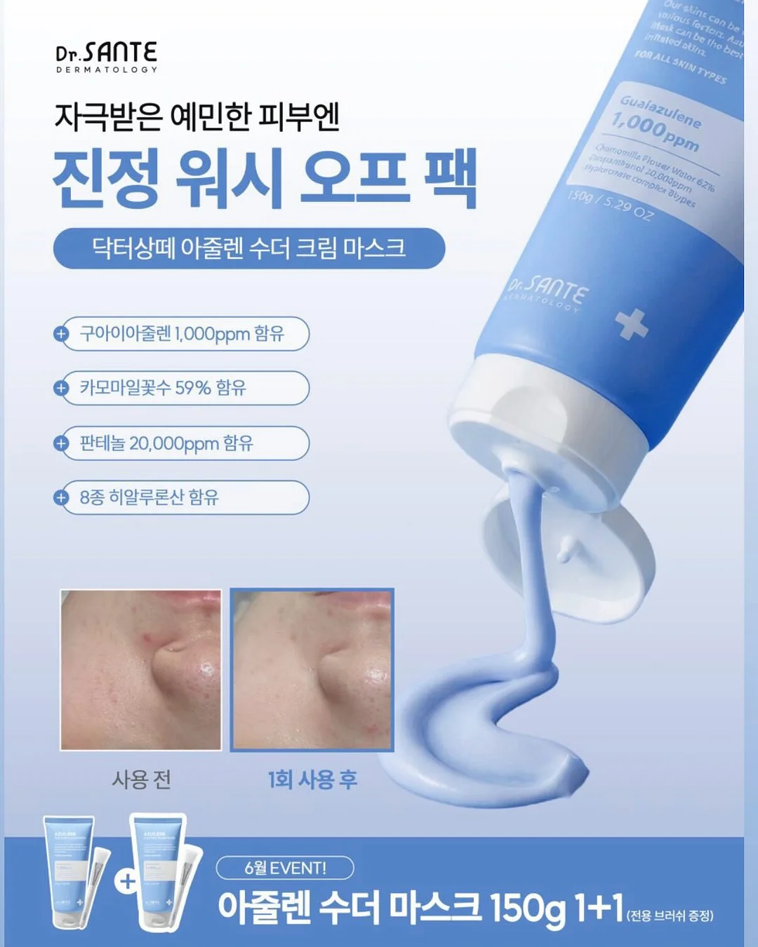 애기발톱 연장 8