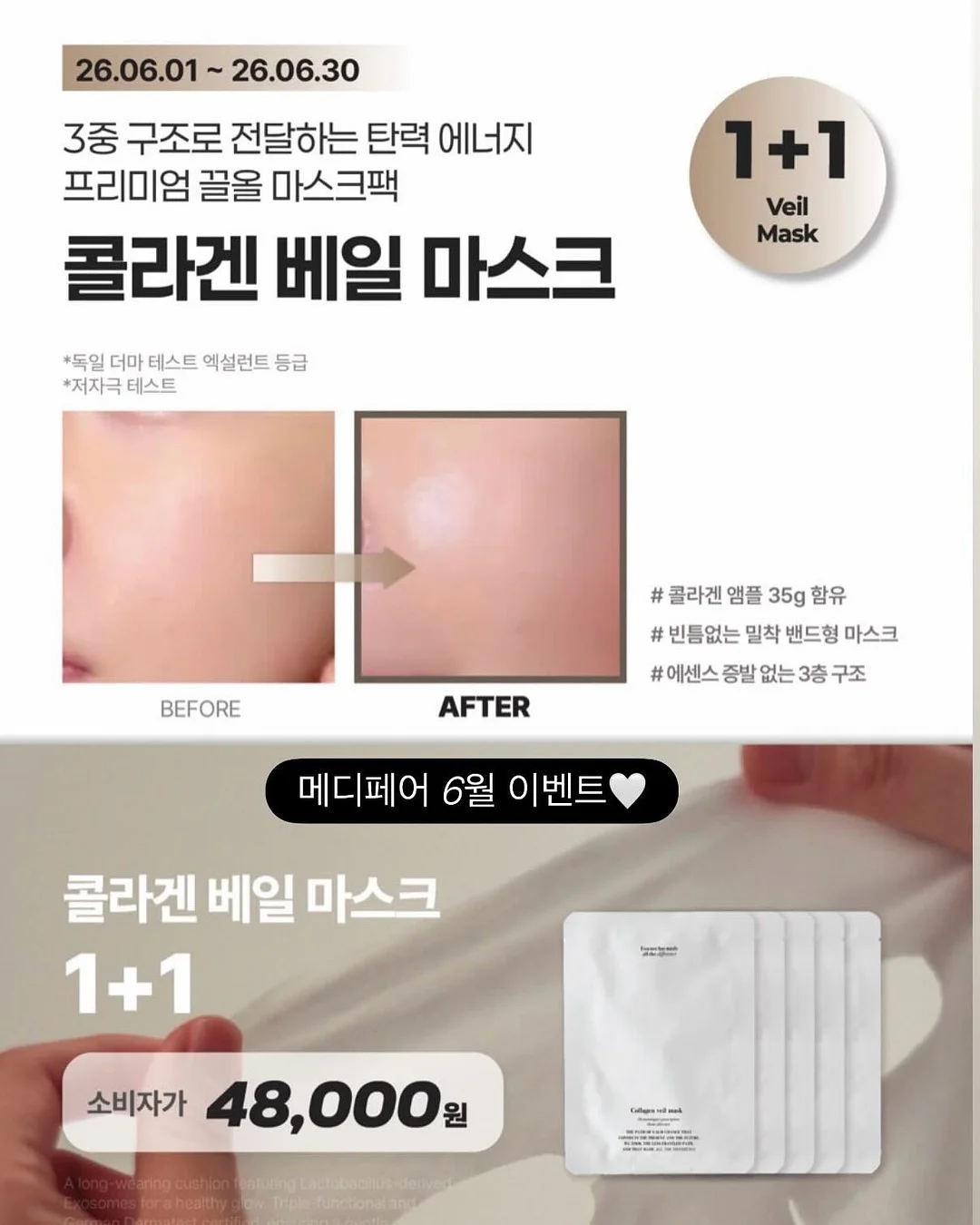 애기발톱 연장 9